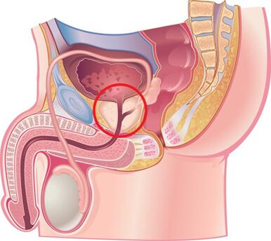 Emplacement de la prostate chez les hommes.