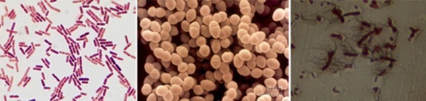 Escherichia coli, entérocoques fécaux et Proteus sont les principaux agents provoquant une prostatite bactérienne chronique.